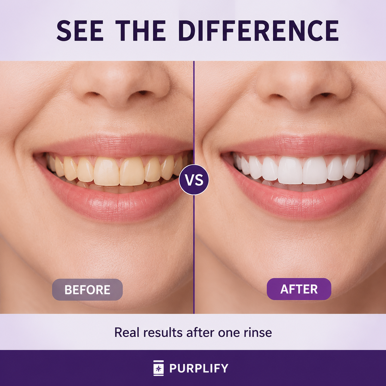 Purplify Whitening Mouthwash (20 Pack)
