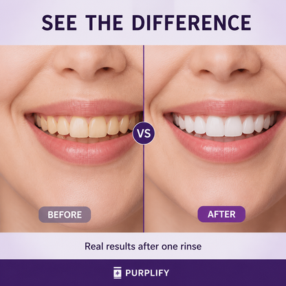 Purplify Whitening Mouthwash (20 Pack)